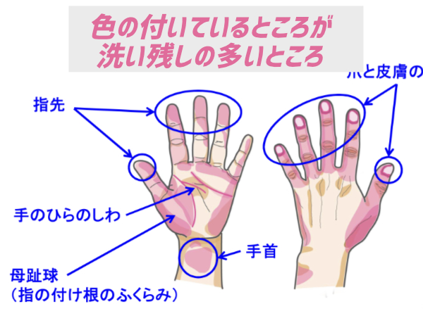 手洗いで洗い残しの多いところ