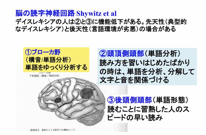脳の読字神経回路についての解説